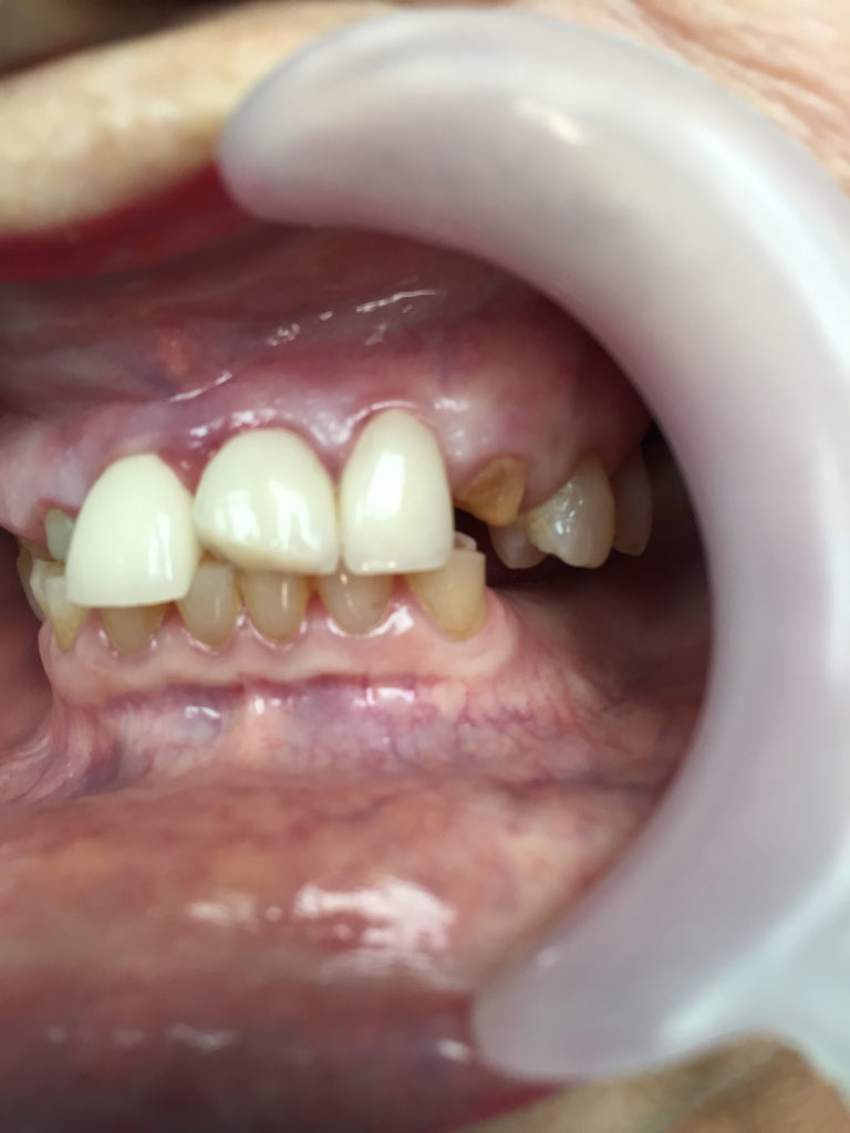 Caso-Dental-Mayo-2015-1