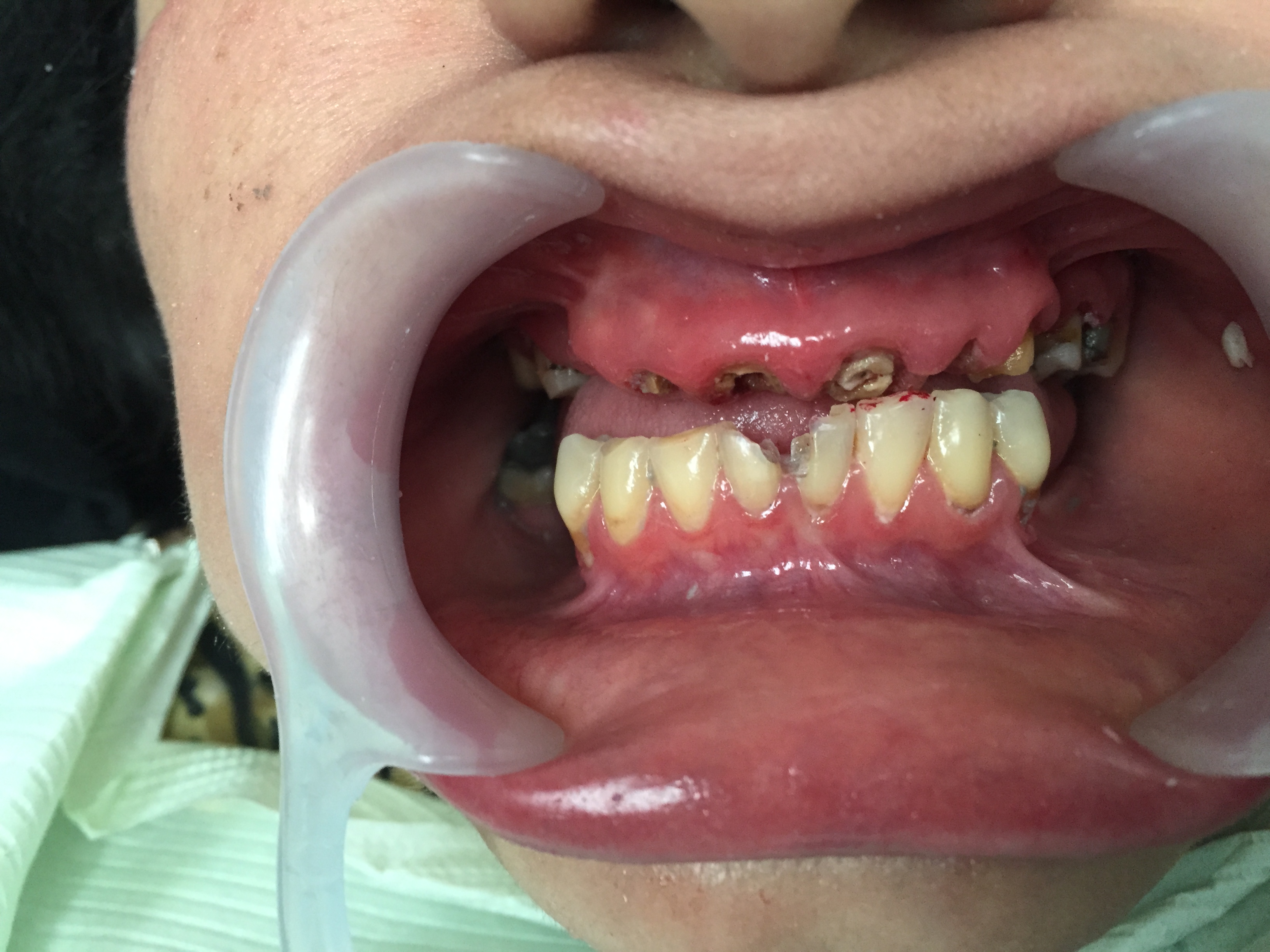 Caso-Dental-Agosto-2015-1