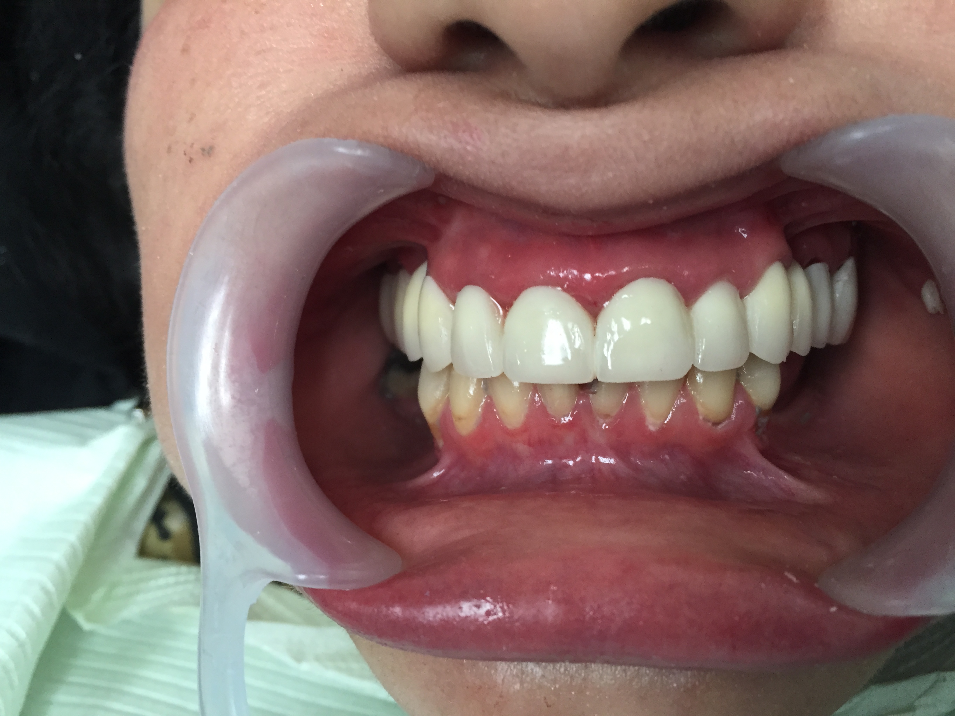 Caso-Dental-Agosto-2015-3