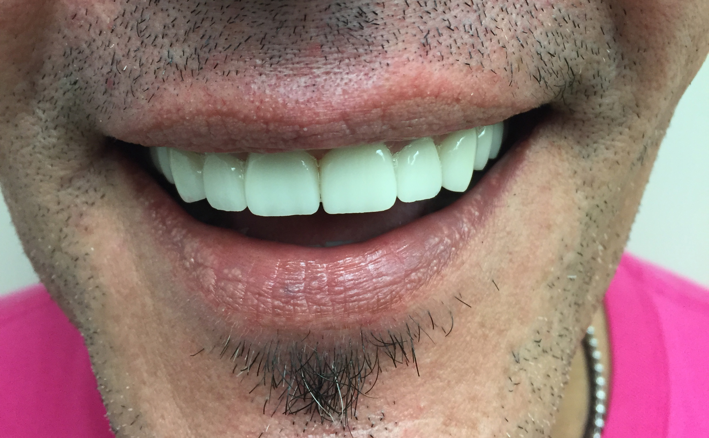 Caso-Dental-Julio-2015-3