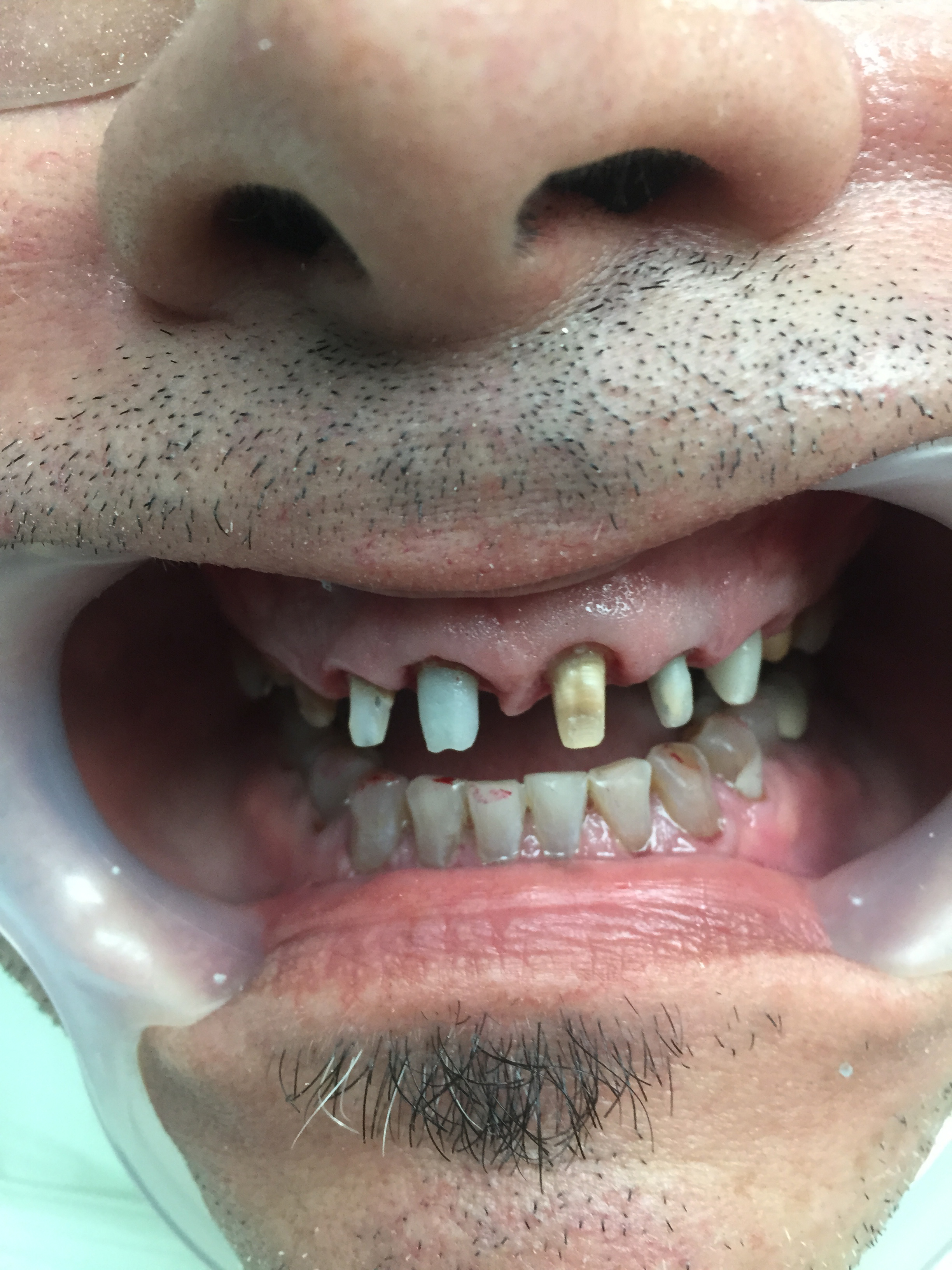 Caso-Dental-Julio-2015-2-BW