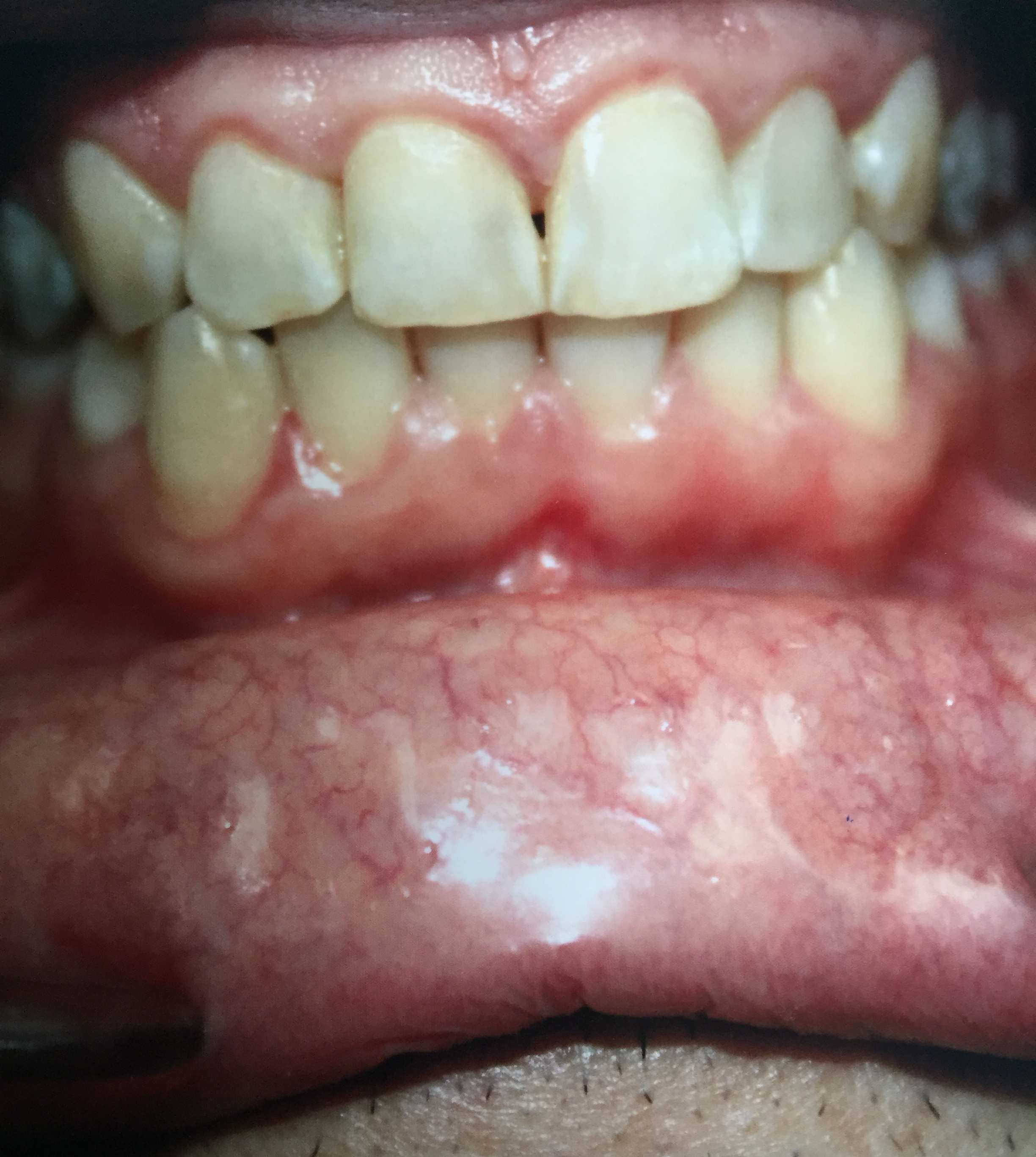 Caso-Dental-Noviembre-2015-1