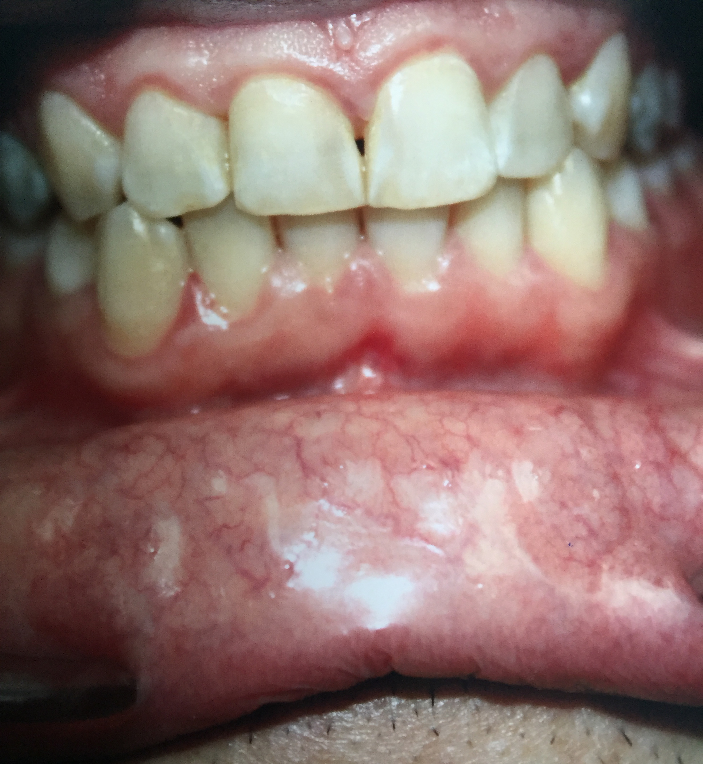Caso-Dental-Noviembre-2015-2