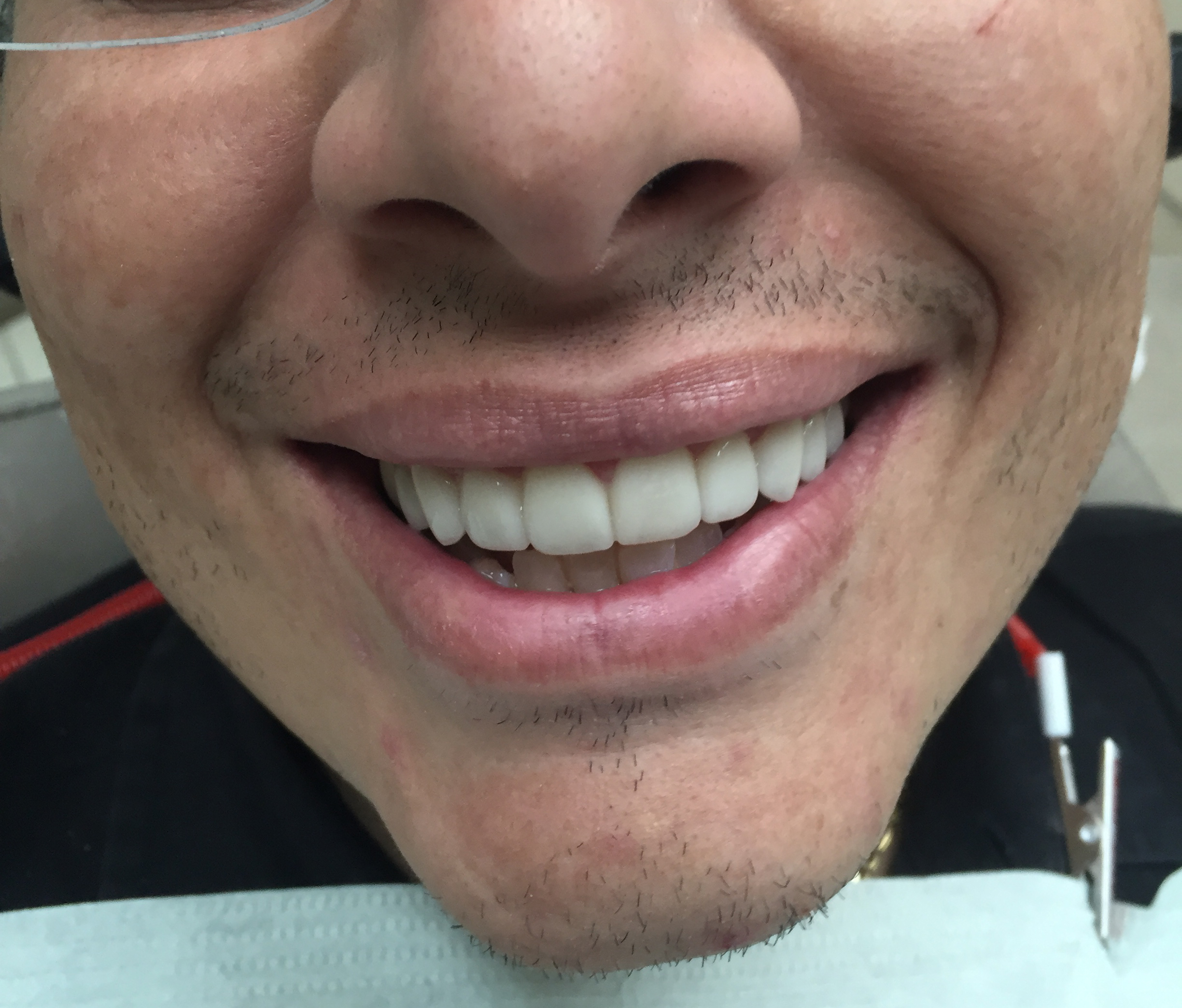 Caso-Dental-Noviembre-2015-5