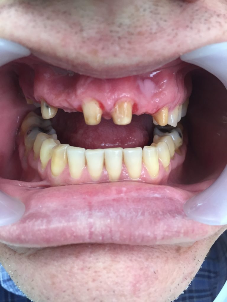 Caso Dental Diciembre 2015-1